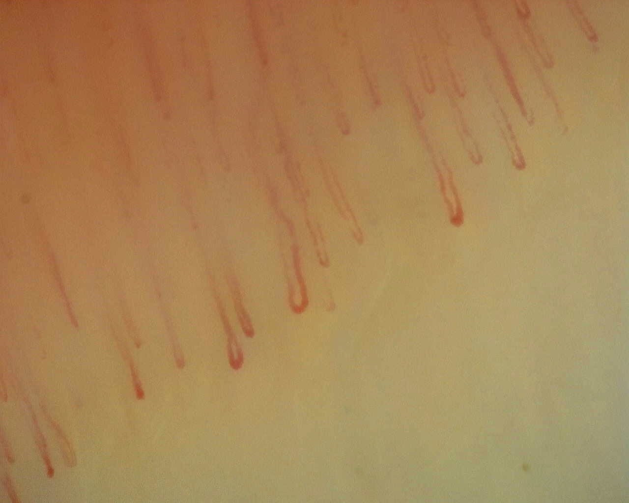 Capillaroscopy with preserved density and nonspecific dilations