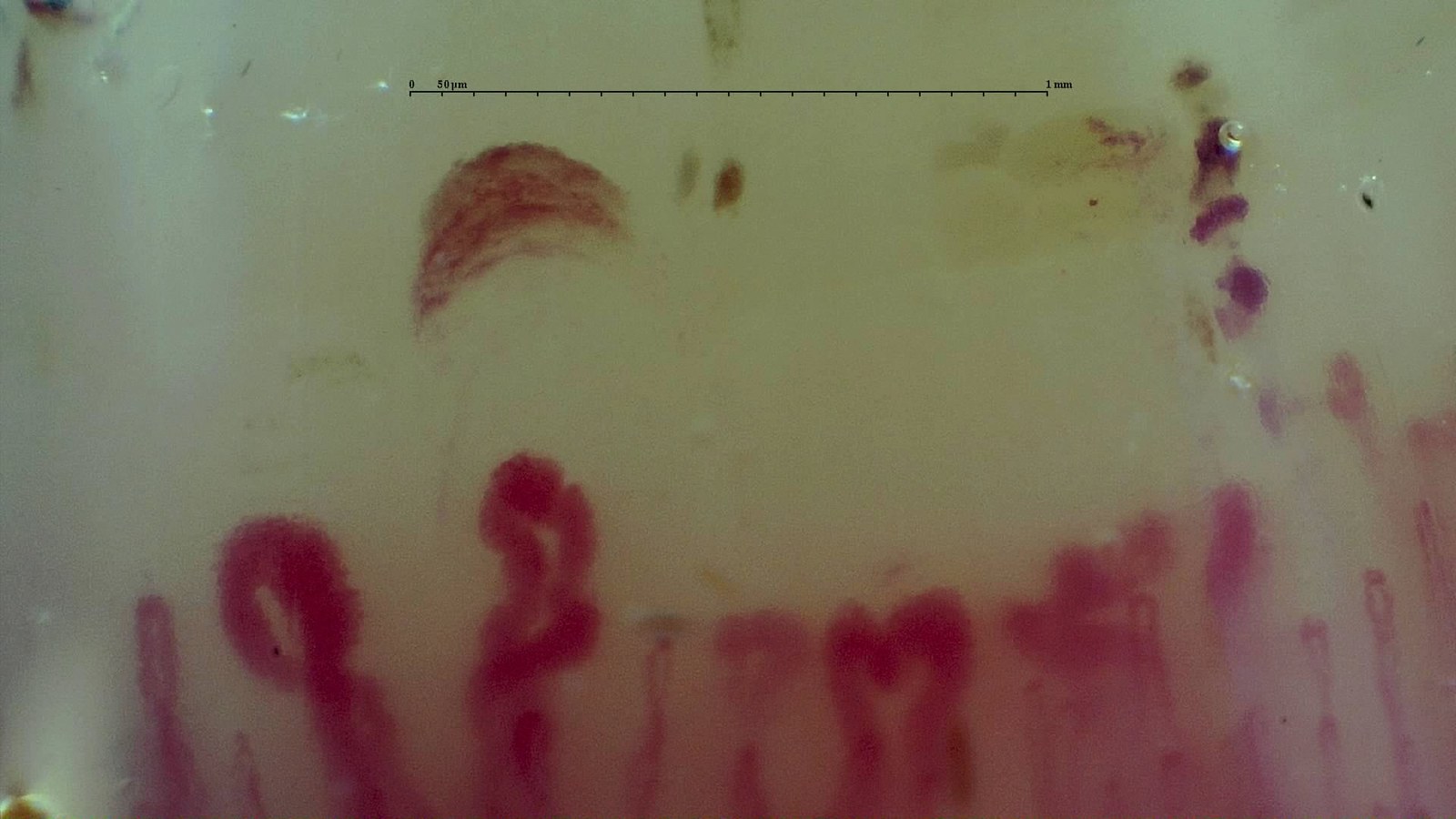Active Cutolo pattern