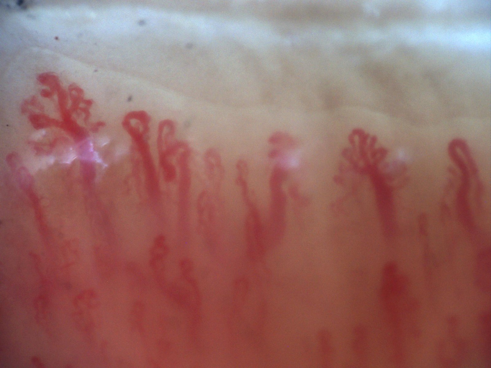Tree-like capillary as a morphological example of new vessel formation
