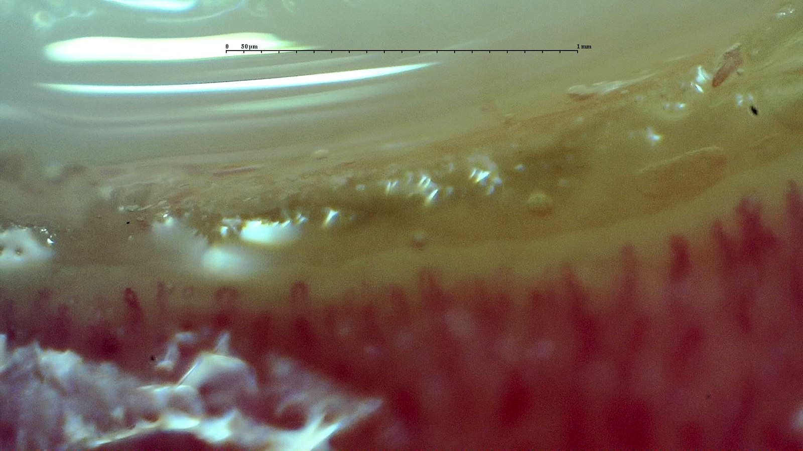 Out-of-focus capillaroscopy field with poorly defined capillaries
