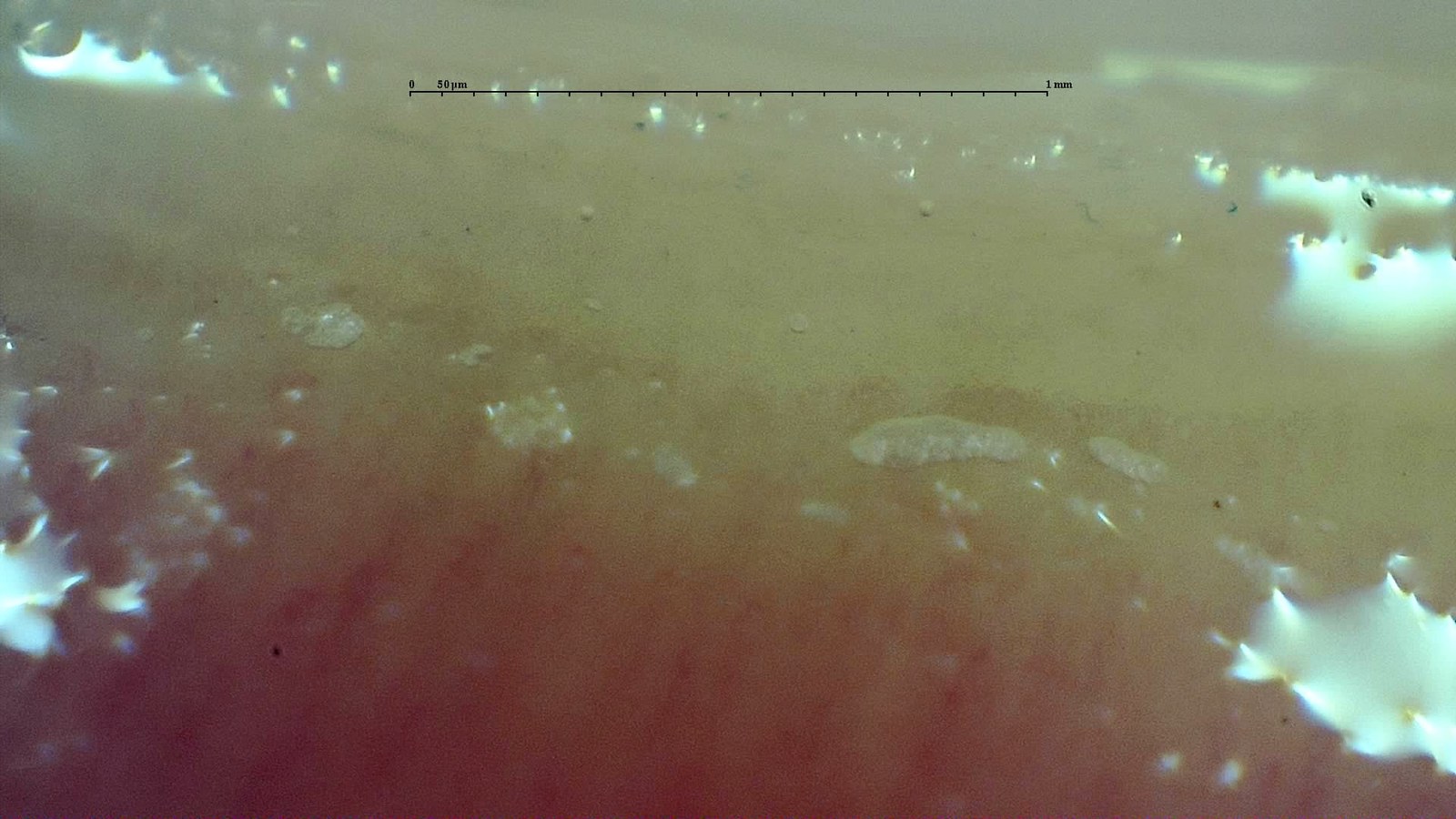 Out-of-focus field in which the capillary row is not safely visible