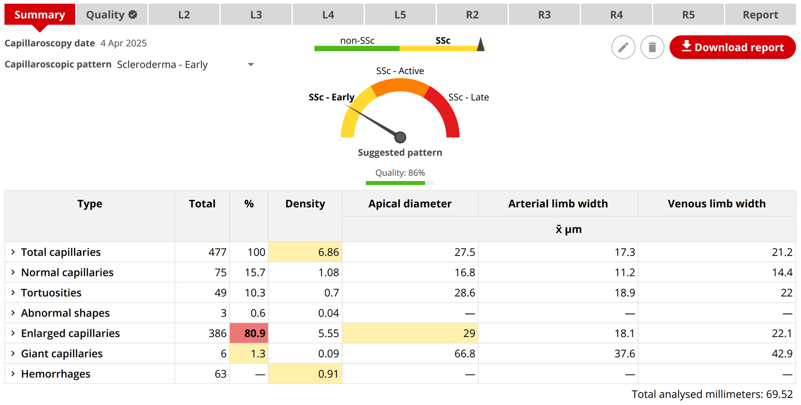 Immediate quantitative report in Capillary.io