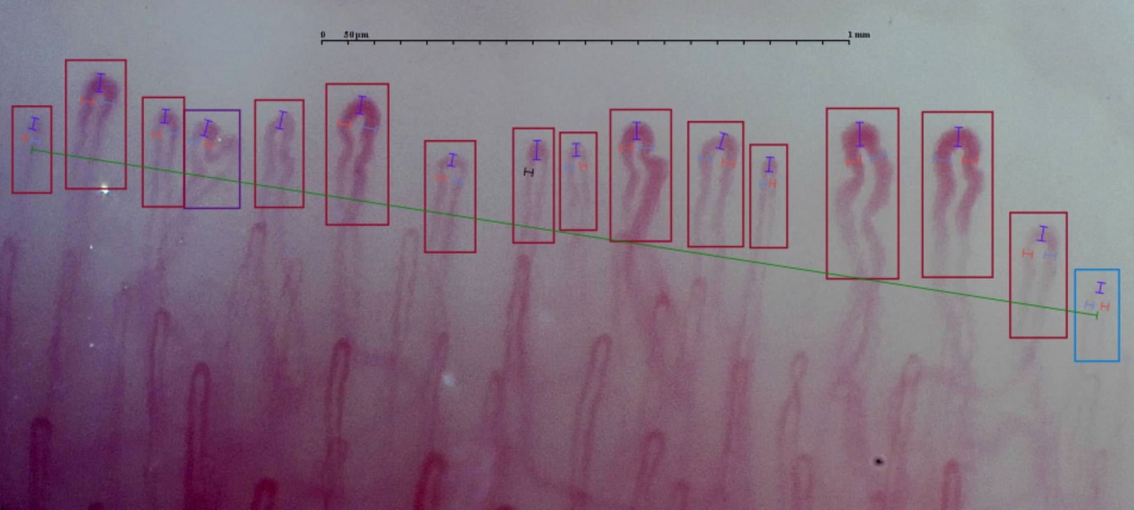 Identification of the first capillary row