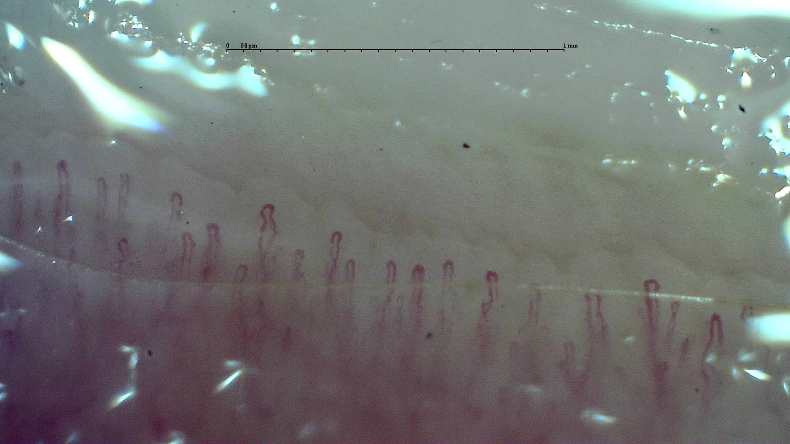 Normal capillary density versus isolated reduced density