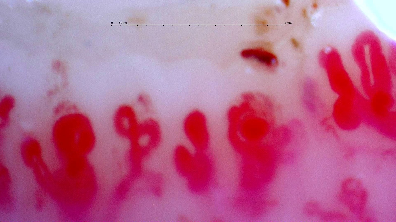 Scleroderma pattern