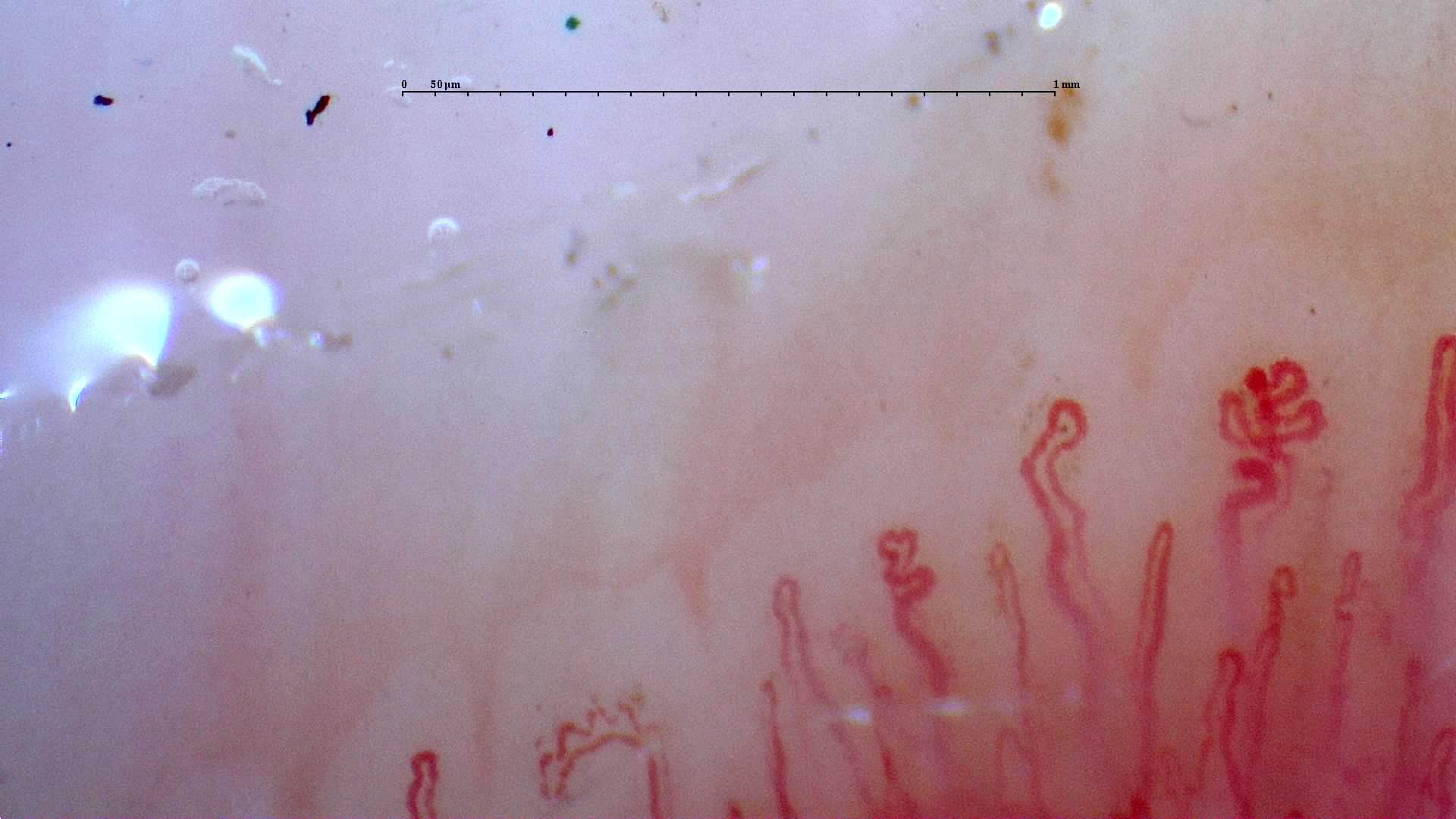 Short loops near the right edge appear connected to a curved limb, beside an elongated hairpin capillary.