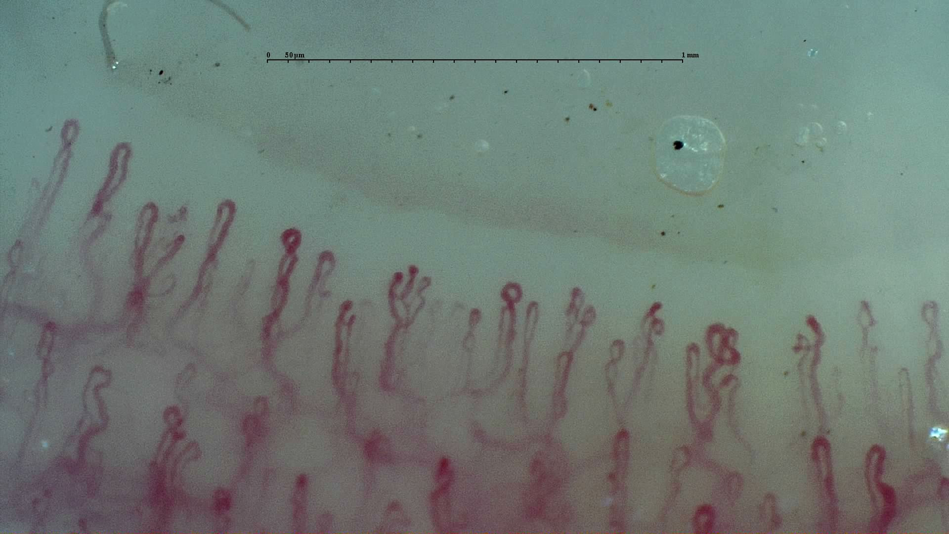 A small branching-appearing capillary near the center, with crossed, curved and folded loops nearby.