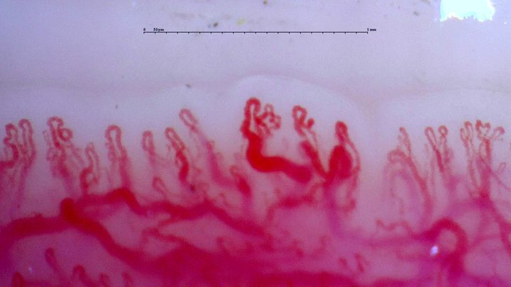 Capillaries with multiple apices and curved tips, above a visible deeper vascular network.