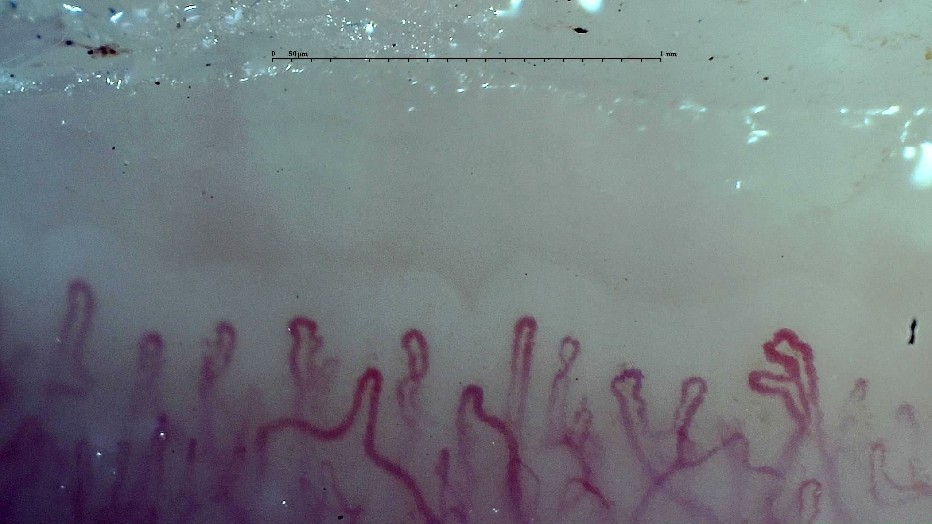 A capillary with several lateral loops near the right edge, beside capillaries with simpler rounded apices.