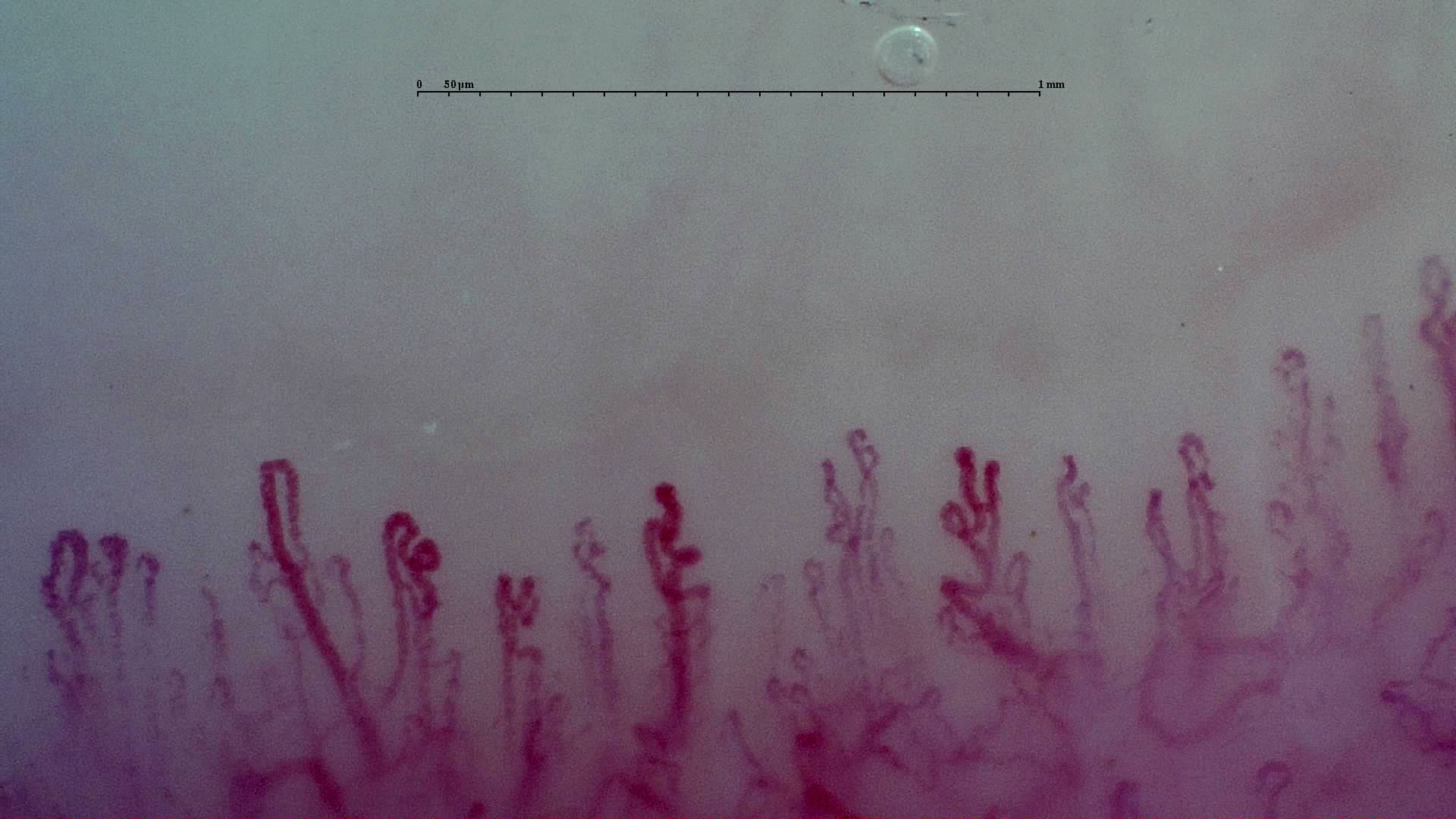 A capillary with a bifurcated appearance right of center, with twisted and coiled loops nearby. The deeper vascular network is visible.