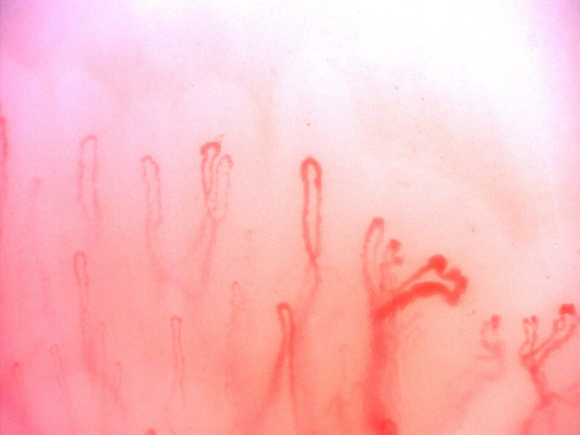 A capillary with two lateral loops at the lower right, with taller simple hairpin capillaries above it.
