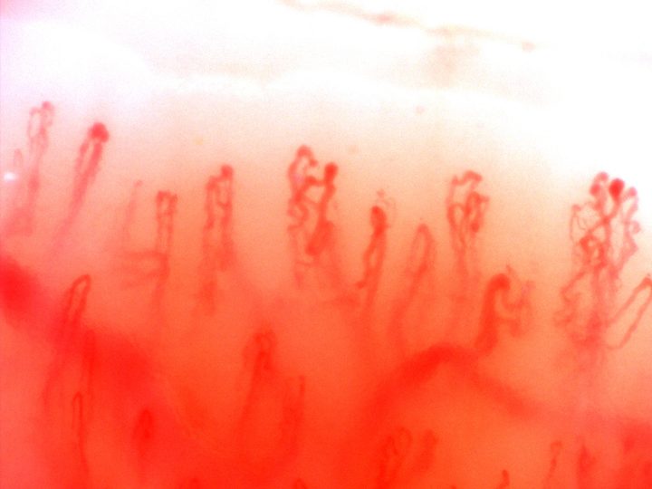 Several capillaries with multiple rounded apices, especially in the center and at the right edge.