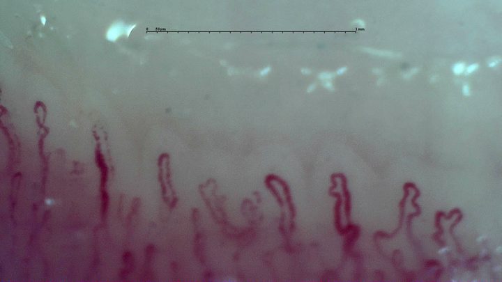 Broad capillaries with lateral bends and folded or hooked apices. Some taller hairpin loops on the left are simpler.