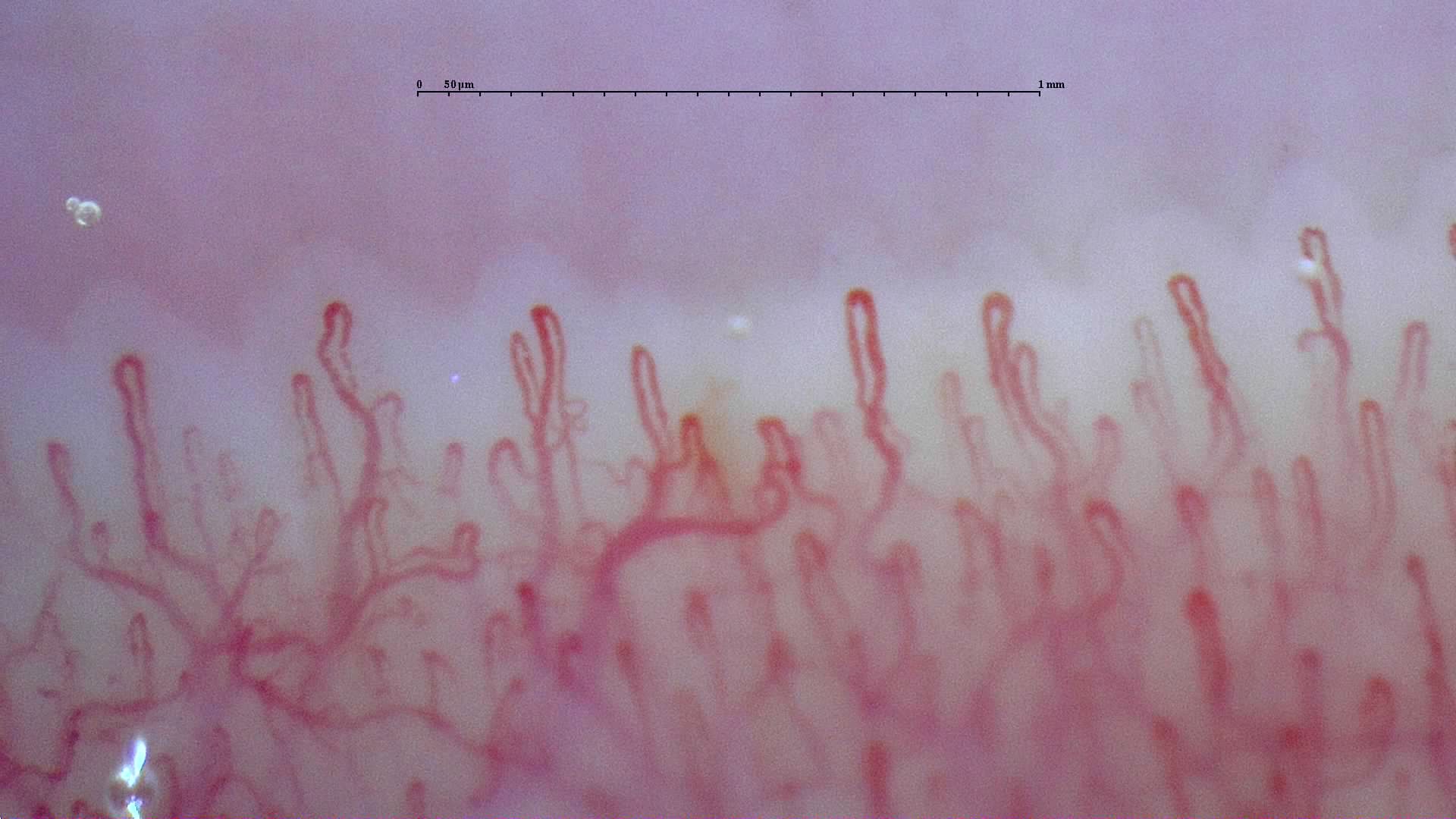 Rounded hairpin capillaries with some curved or overlapping limbs. The deeper vascular network is visible.