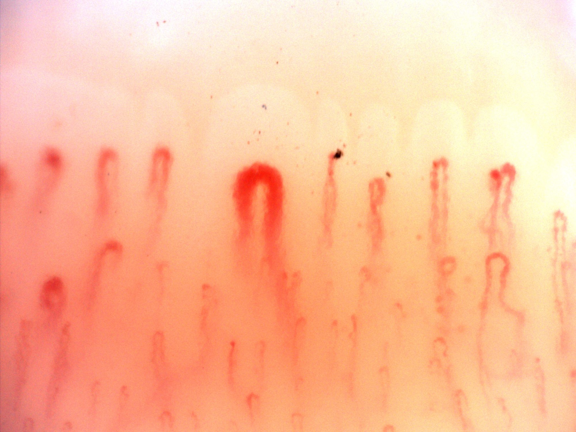 A central giant-appearing capillary with a thick rounded apex and broad limbs, surrounded by finer loops.