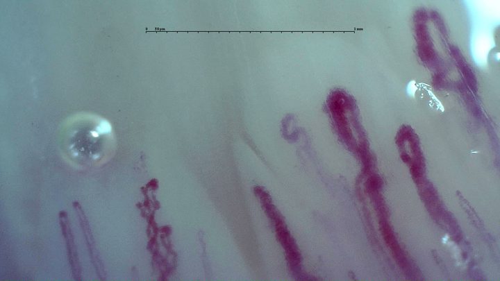 Several elongated giant-appearing capillaries on the right, with thick rounded apices and limbs. Finer and irregular loops lie to the left.