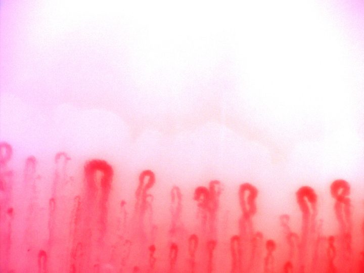 A giant-appearing capillary with a broad rounded apex on the left, beside smaller coiled and crossed loops.