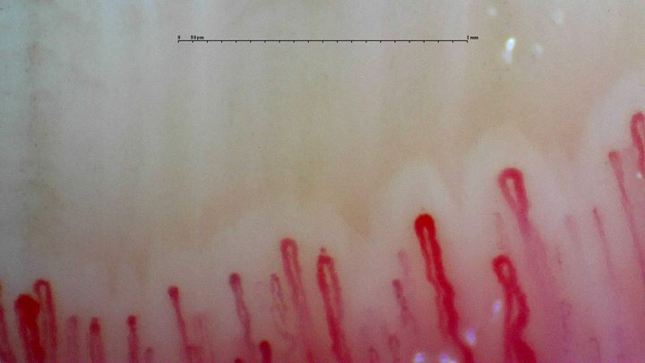 Several enlarged rounded apices and a tortuous limb on the right, mixed with finer capillaries.