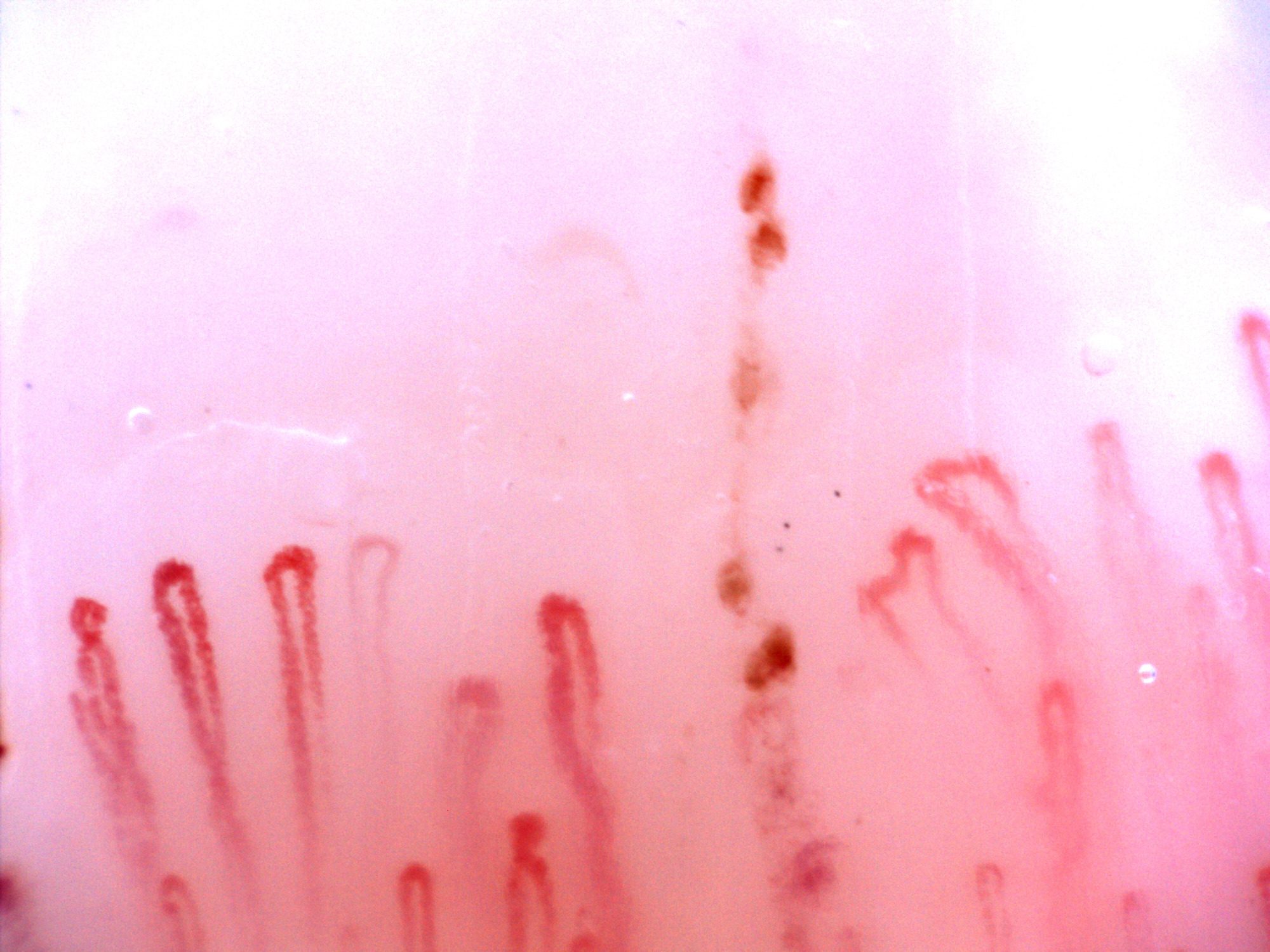 Capillaries with rounded apices of different widths and some irregular limbs. Brown-red hemorrhagic deposits form a vertical row near the center-right.