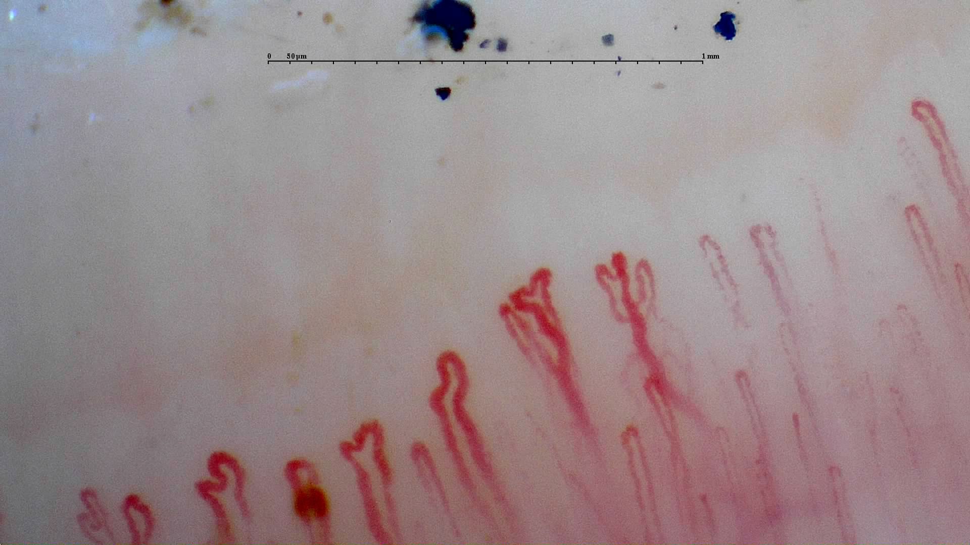 Capillaries with paired or accessory apices, especially near the center-right. Blue-black surface fragments lie above the row.
