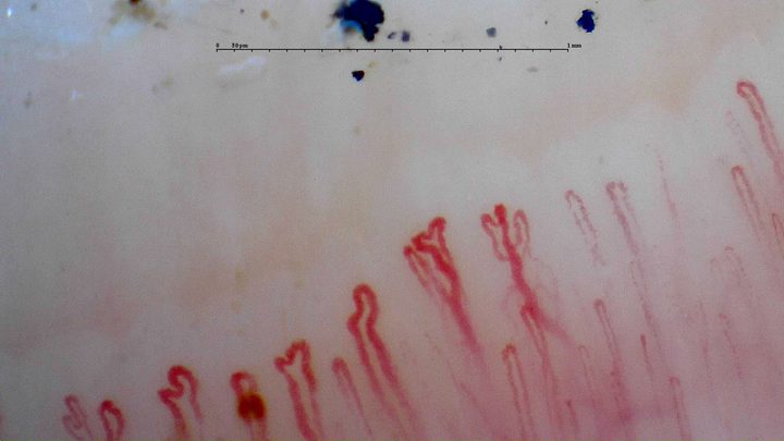 Capillaries with paired or accessory apices, especially near the center-right. Blue-black surface fragments lie above the row.