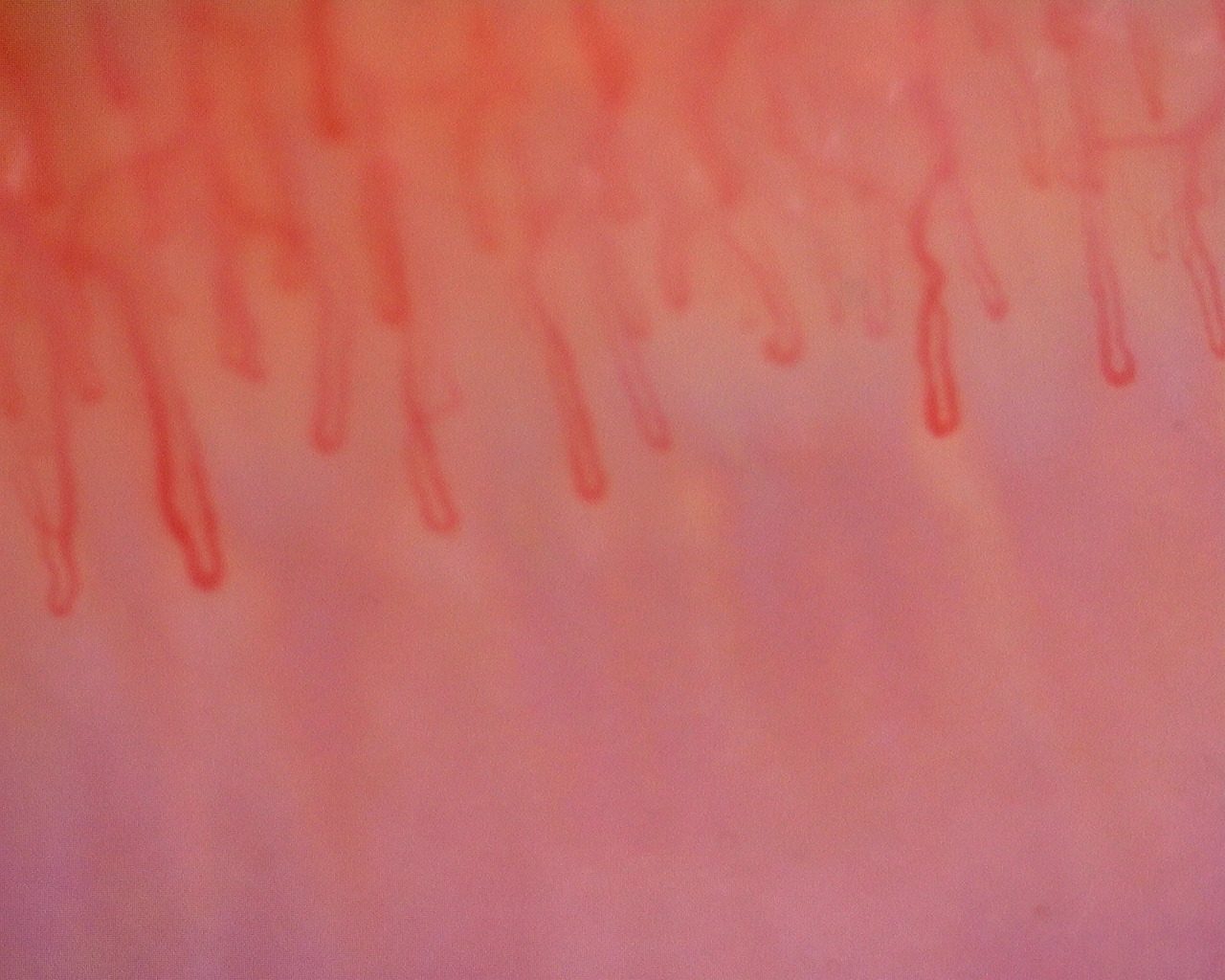 Long hairpin capillaries with parallel limbs. The loop on the left is wider than the others.