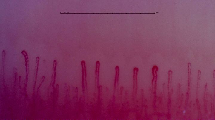 Hairpin capillaries of different widths. One loop right of center has a broader rounded apex.