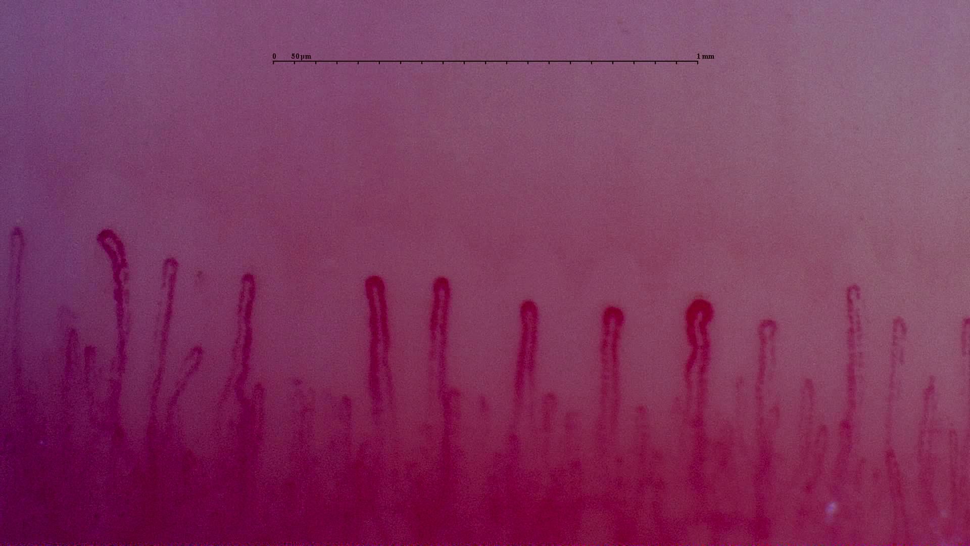 Hairpin capillaries of different widths. One loop right of center has a broader rounded apex.