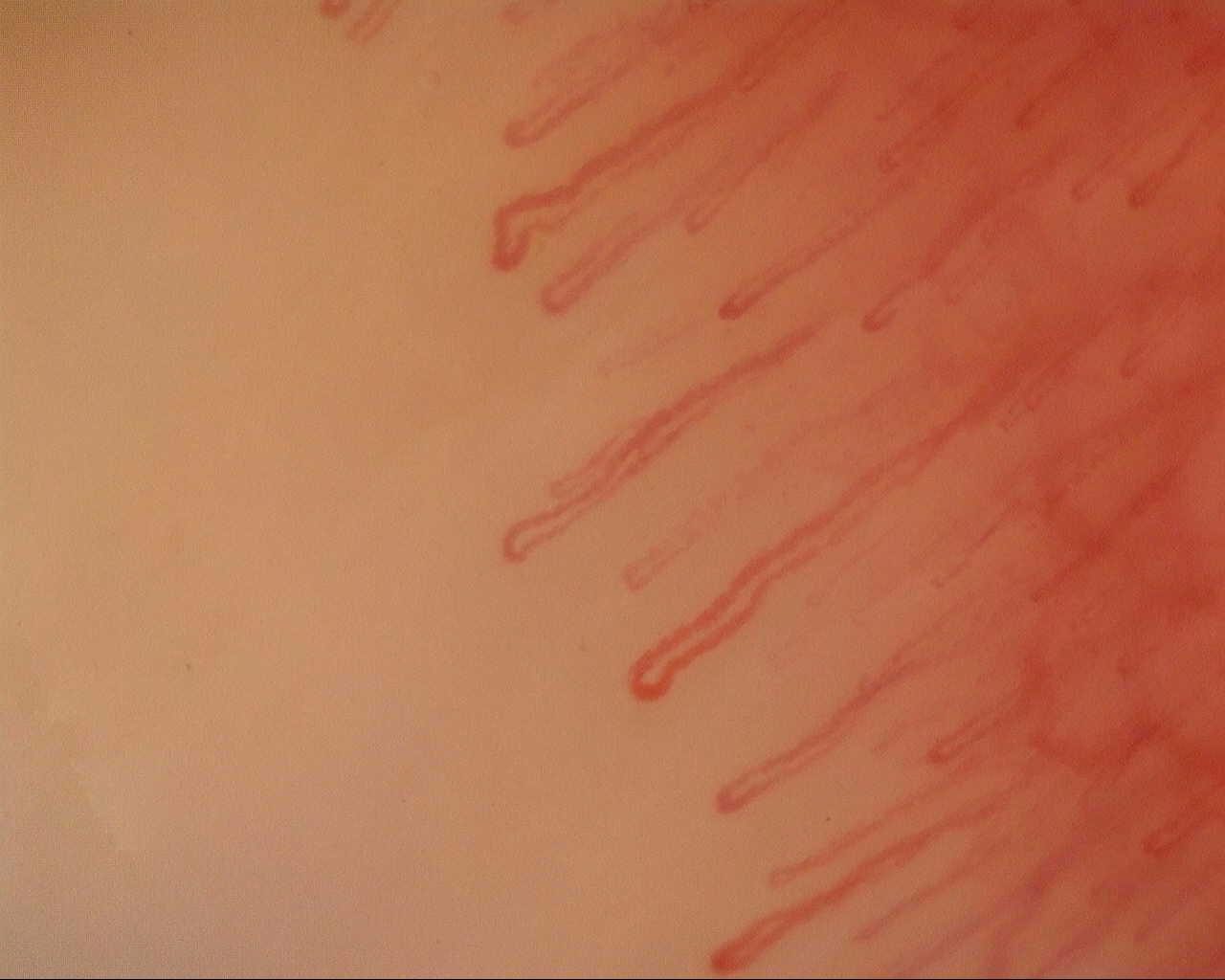 Long hairpin capillaries mixed with thicker, mildly tortuous loops.