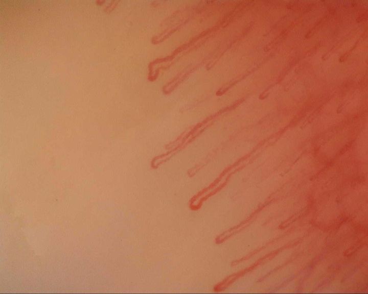 Long hairpin capillaries mixed with thicker, mildly tortuous loops.