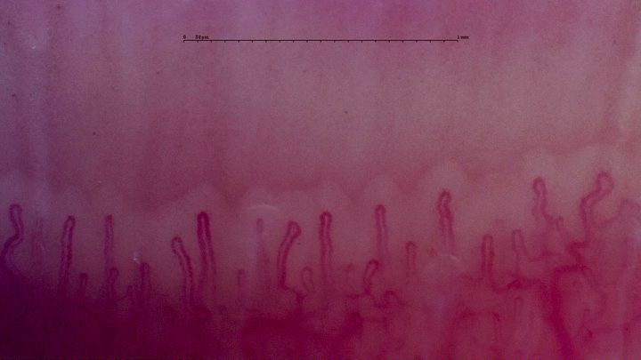 Slender hairpin capillaries with a tortuous loop at the far right.
