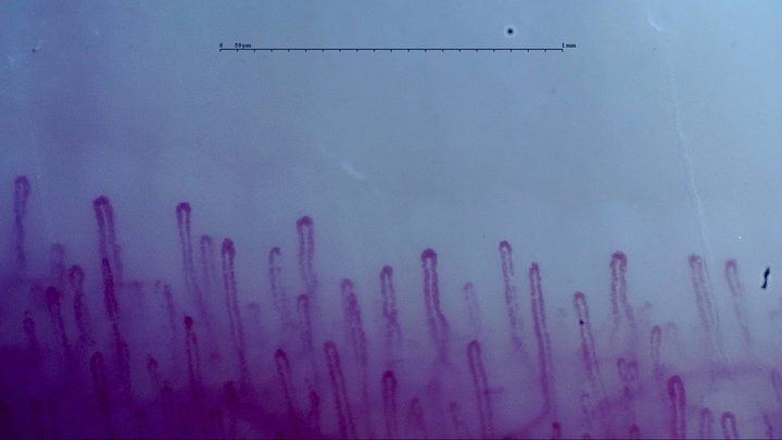 Hairpin capillaries with rounded apices, some enlarged. Finer loops are visible between them.