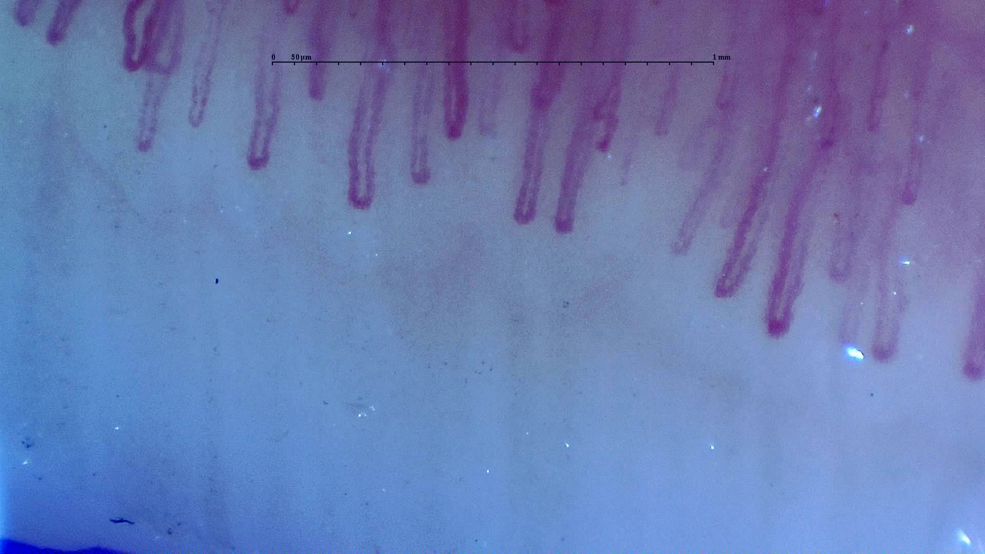 Long, broad hairpin capillaries with mostly parallel limbs and variable apical widths.