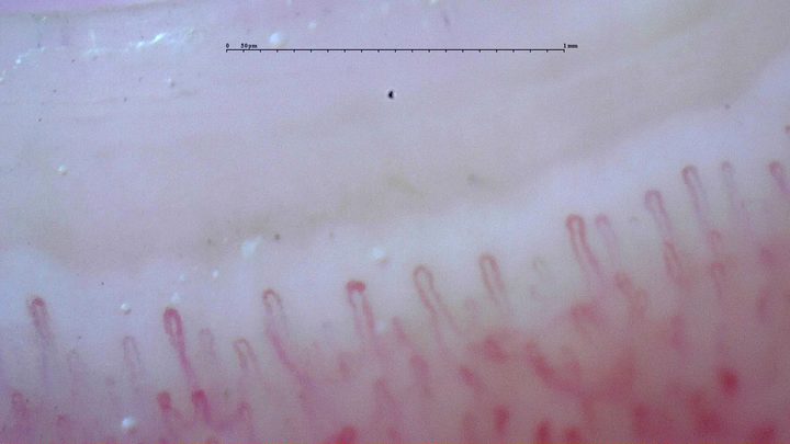 Fine hairpin capillaries with simple rounded apices. Some lower limbs are less clearly visible.