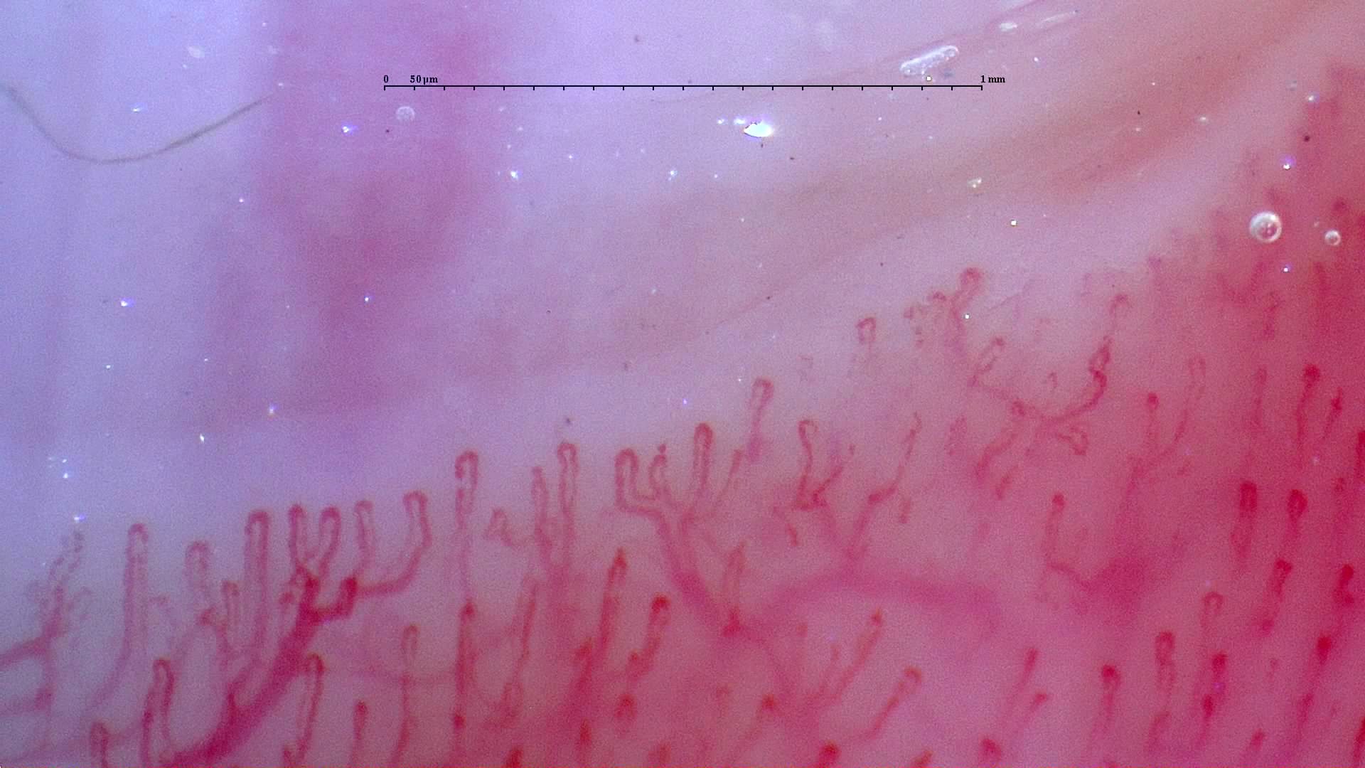 Short hairpin capillaries on the left, with curved, overlapping and possibly branching loops on the right.
