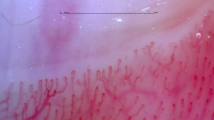 Short hairpin capillaries on the left, with curved, overlapping and possibly branching loops on the right.