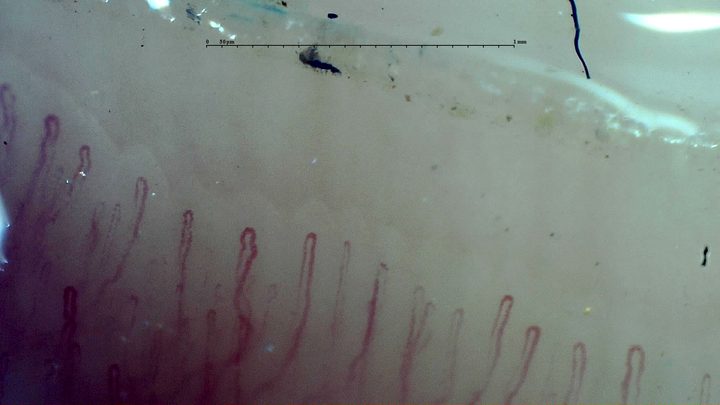 Thin, elongated hairpin capillaries. Dark surface debris is visible above the row.