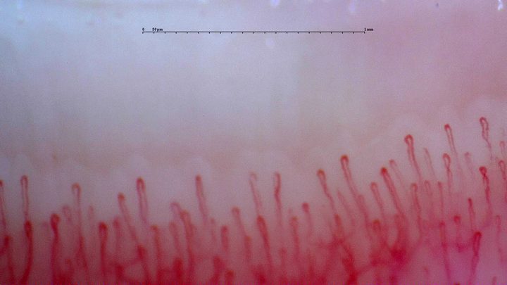 Slender hairpin capillaries with mostly aligned apices and shorter vessels in the background.