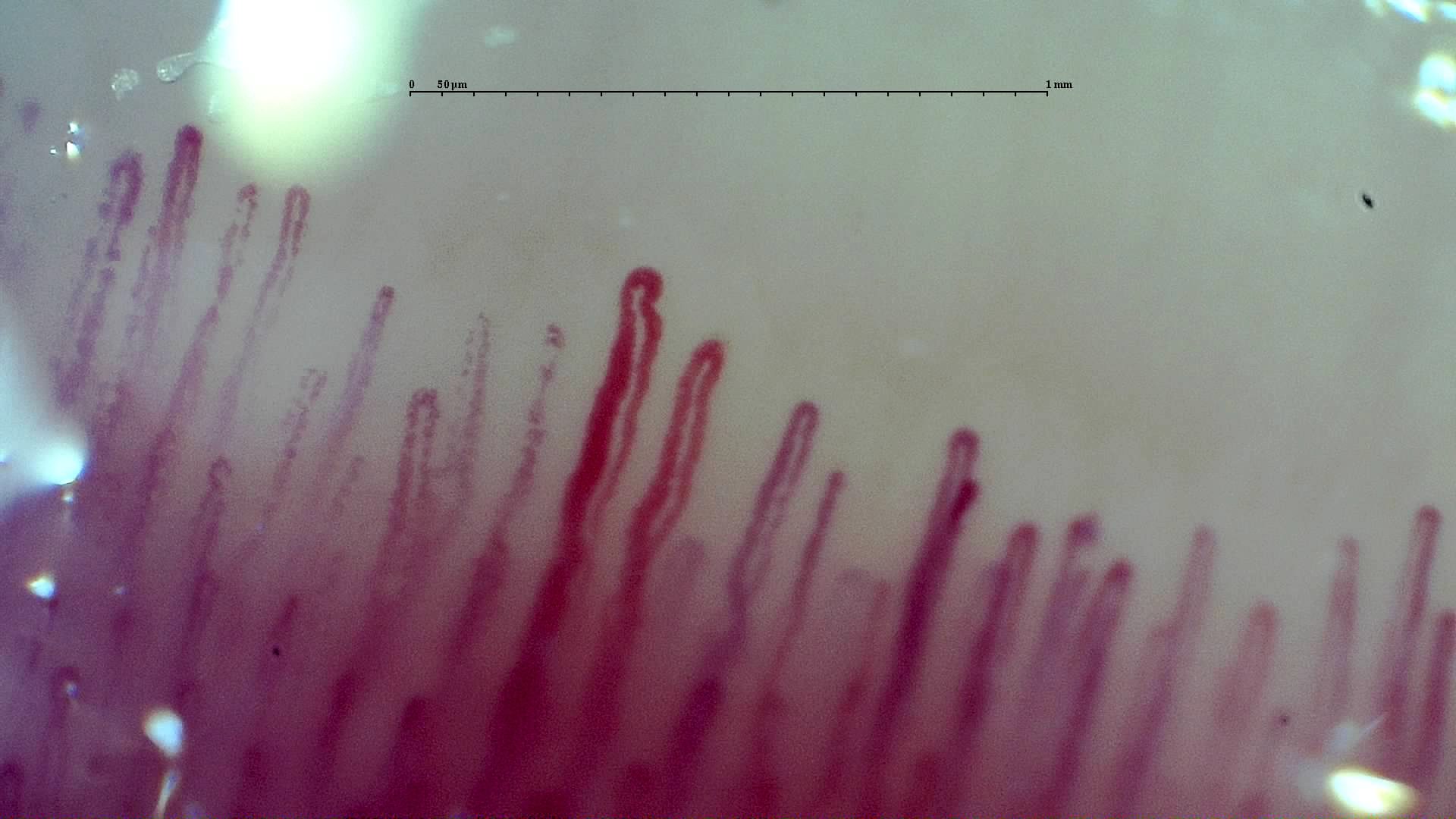 One enlarged elongated capillary near the center, with narrower hairpin loops on both sides.