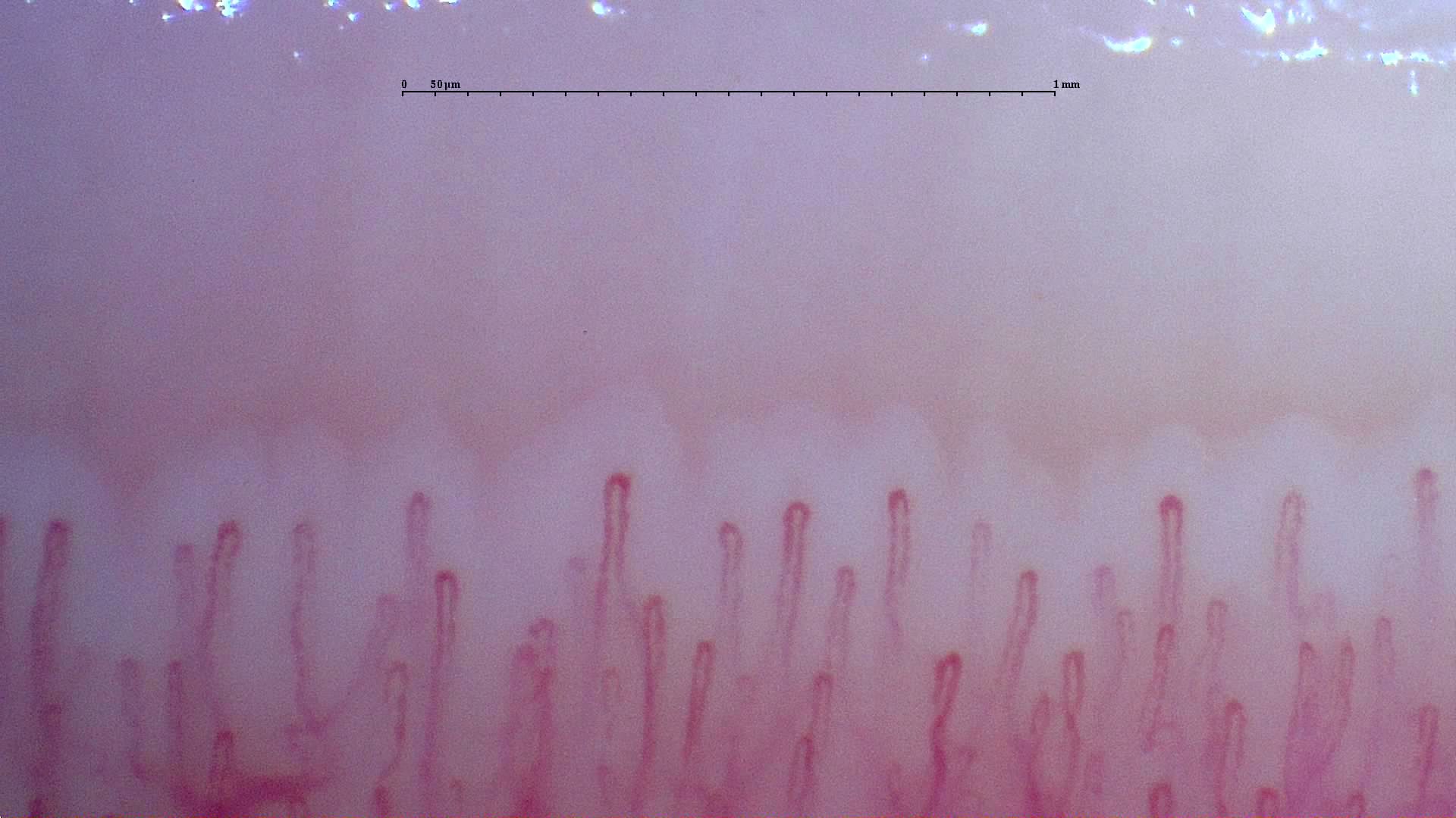 Narrow hairpin capillaries with small differences in length and width.