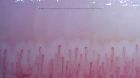 Narrow hairpin capillaries with small differences in length and width.