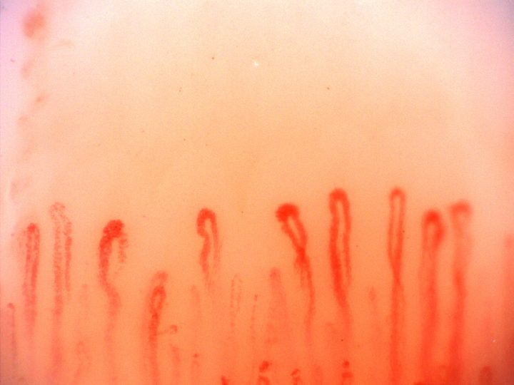 Several capillaries have enlarged rounded apices and narrower elongated limbs. Some loops have mild bends.
