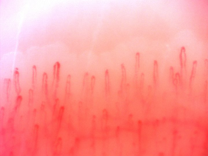 Fine hairpin capillaries with simple rounded apices and variable visible lengths.