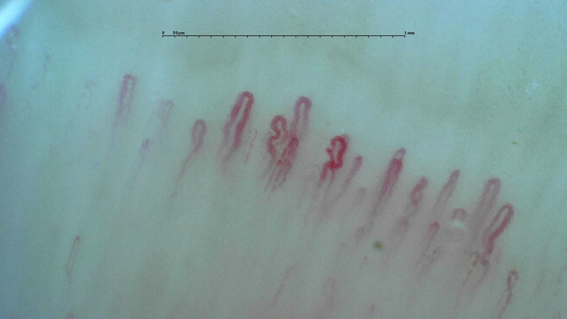 Two capillaries with irregularly curved apices in the center, between taller open hairpin loops.
