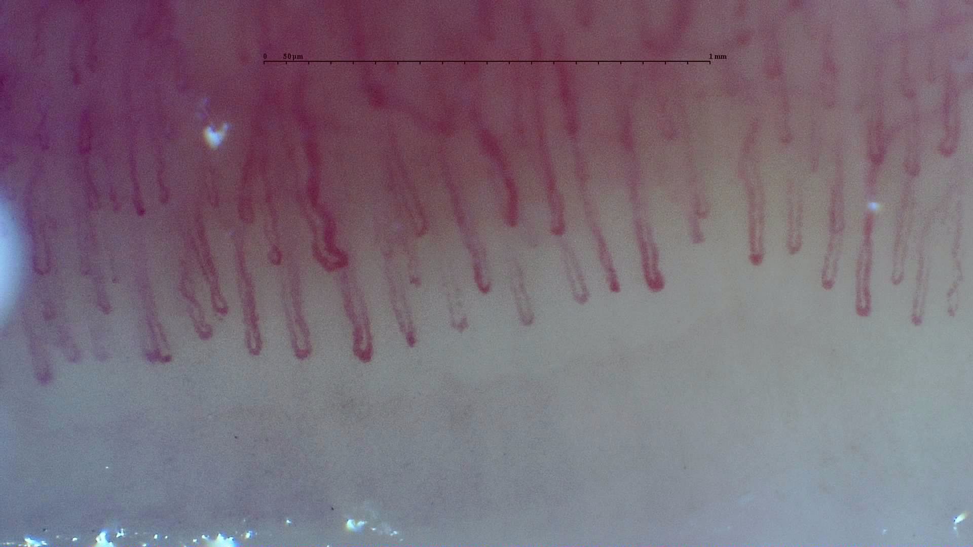 A long tortuous capillary near the left-center, surrounded by straighter elongated hairpin loops of different widths.