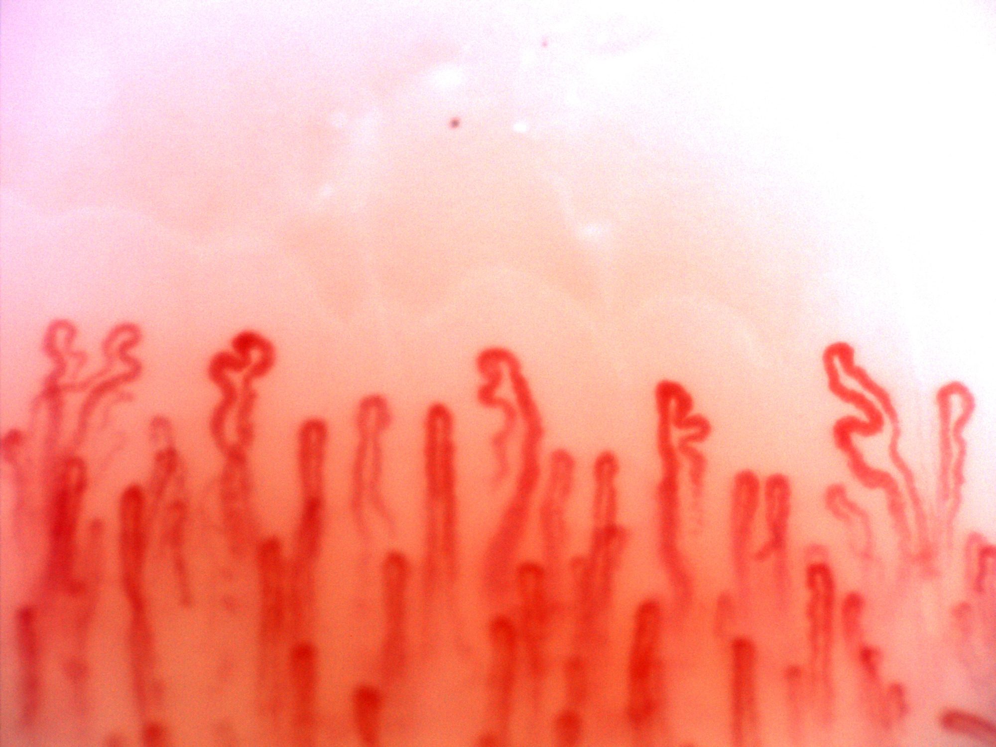 Capillaries with hooked and folded apices, beside straighter loops with parallel limbs.
