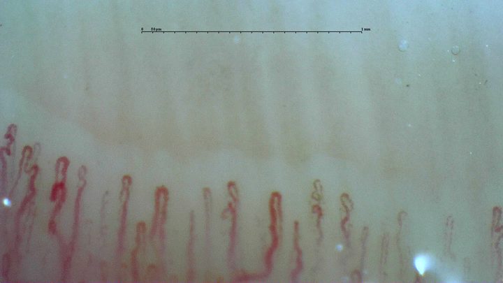 Small coiled apices beside thicker, straighter hairpin capillaries. Some limbs bend near the apex.