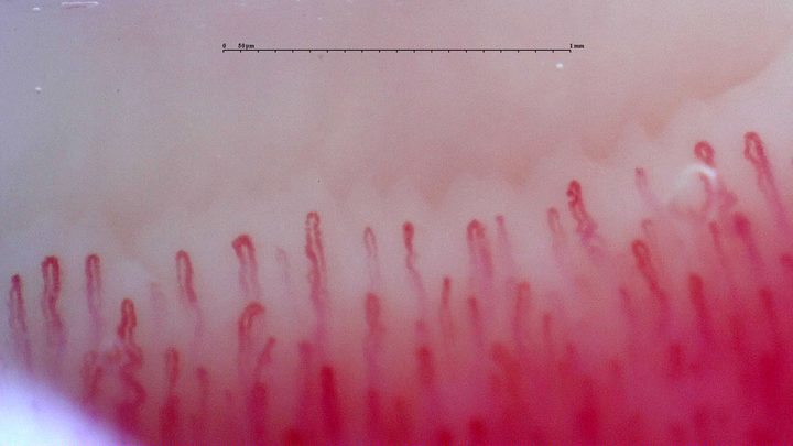 Rounded capillary apices of different widths, with a short twisted limb at the lower left.