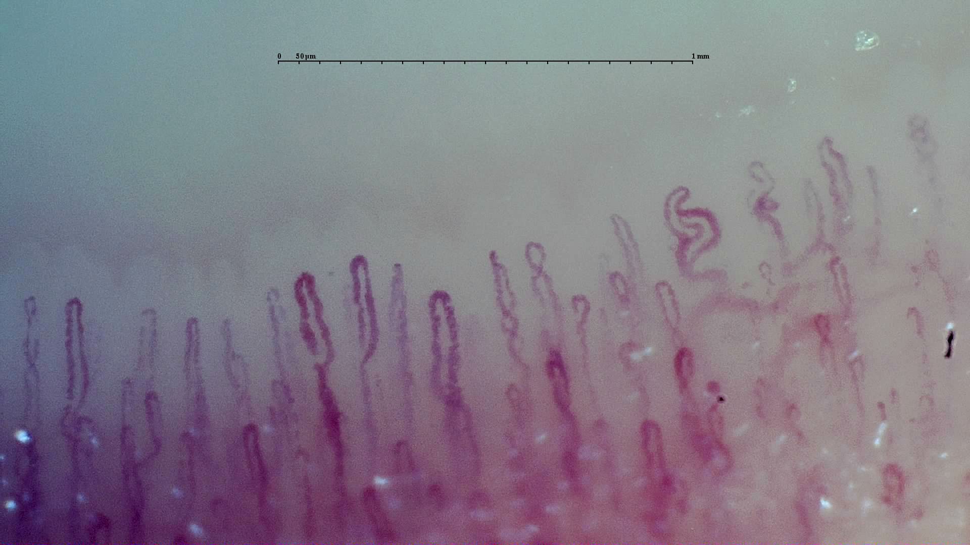 A broad S-shaped capillary at the upper right, with smaller curved loops and straighter hairpin capillaries nearby.