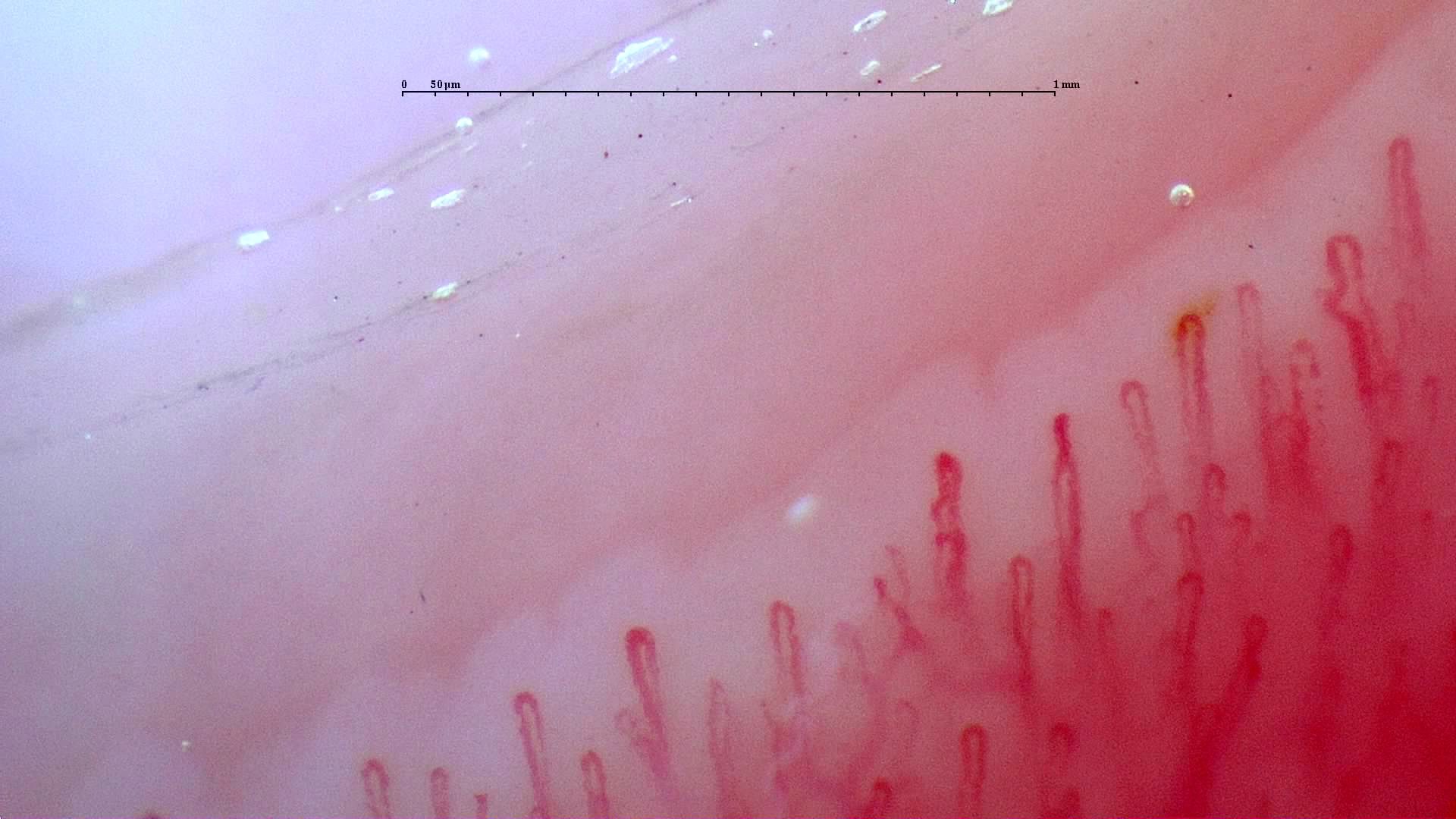 Fine capillaries with mild twists near some right-sided apices. The loops on the left are simpler hairpins.
